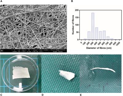 Optimisation of a Novel Bio-Substrate as a Treatment for Atrophic Age-Related Macular Degeneration